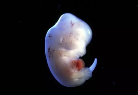 胚胎.JPG