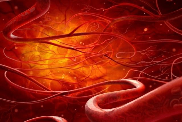 血管.jpg 血管.jpg