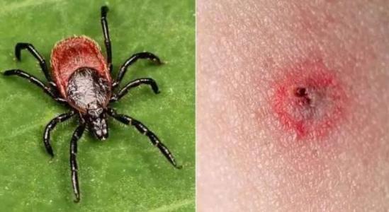 u=4028444066,2743604758&fm=26&gp=0.jpg u=4028444066,2743604758&fm=26&gp=0.jpg