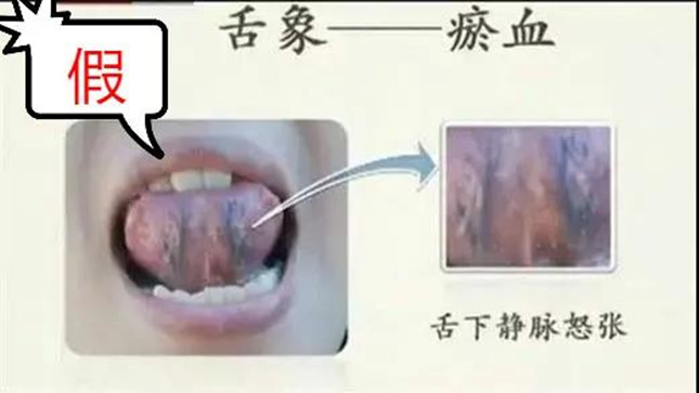 nei 00721151752_副本.jpg nei 00721151752_副本.jpg