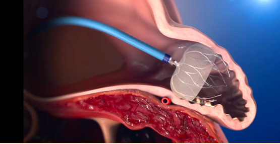 屏幕快照 2021-06-06 上午8.14.13.png 屏幕快照 2021-06-06 上午8.14.13.png