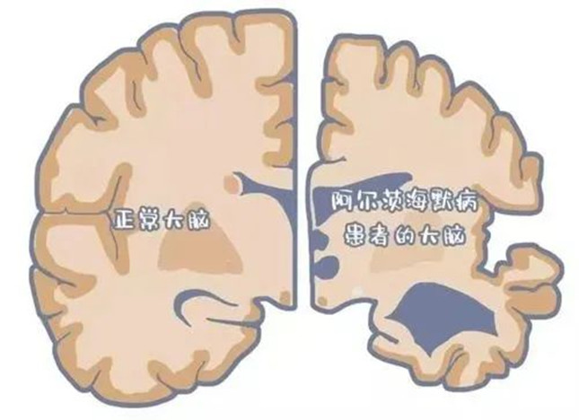 nei 141144_副本.jpg nei 141144_副本.jpg